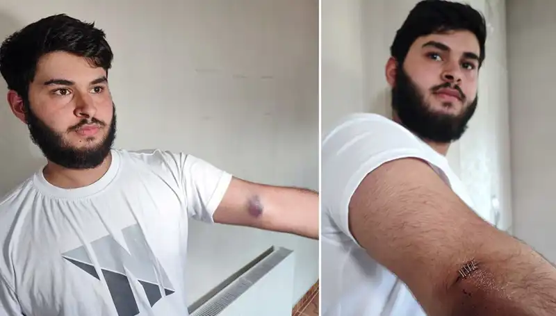 Bahçeye Kaçan Top Ekstra Yıldızlarla Dolu Olayı Başlattı!