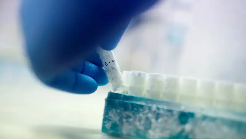 Tıbbi Felaket! 85 Sperm Donörüyle Binlerce Çocuğa Baba Olundu