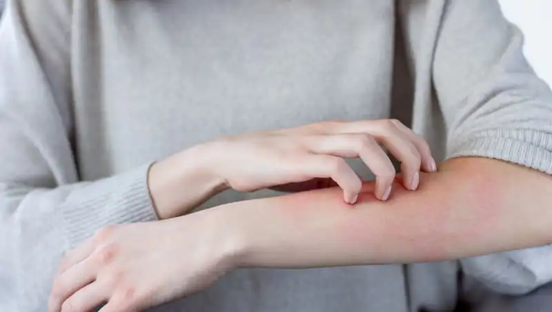 Cilt Kanseri Belirtileri: Dermatologdan Gözden Kaçan İki Uyarı