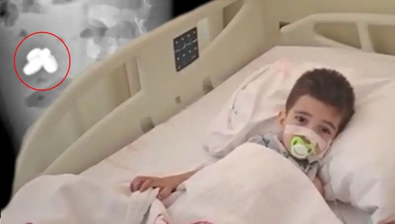 Pil ve Mıknatıs Yutan Çocuğun Dramı: Ailelerine Acı Tecrübeler